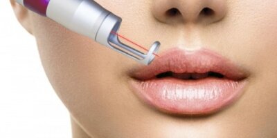Permanent-Make-up-Entfernen-Laser-Avederma-Berlin-600x274