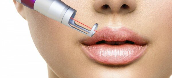 Permanent-Make-up-Entfernen-Laser-Avederma-Berlin-600x274